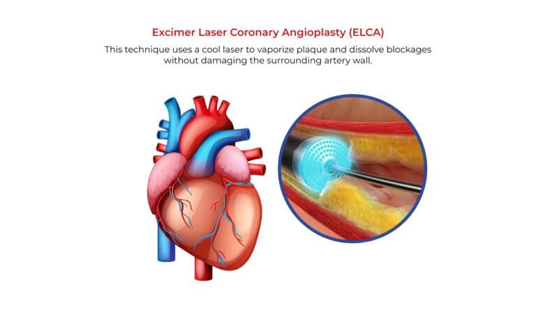 Best Cardiologist in Jubilee Hills