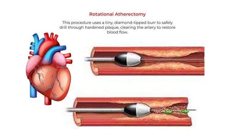Heart Specialist in Warangal