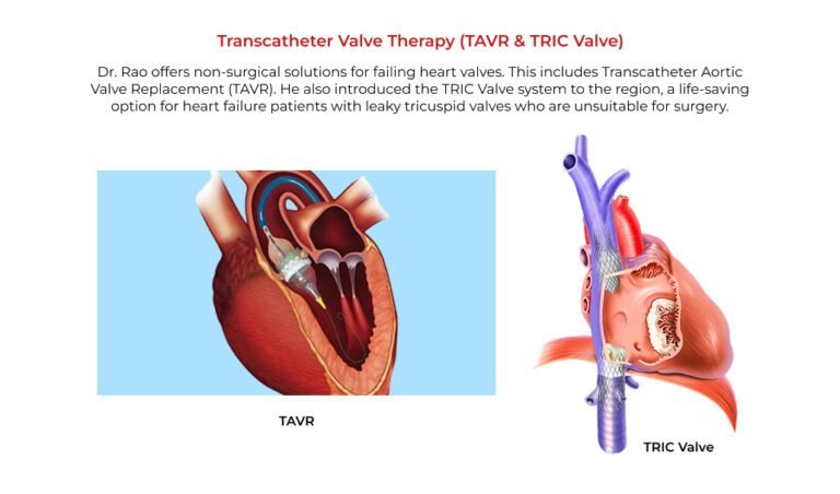 Best Cardiologist in Madhapur